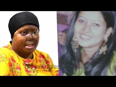 We don't seek your sympathy" Pragya, acid attack survivor - YouTube